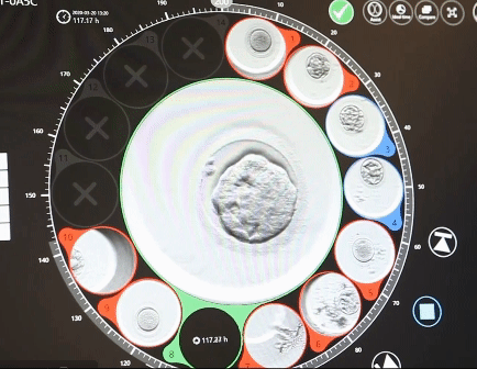 Embryoscope Time-lapse