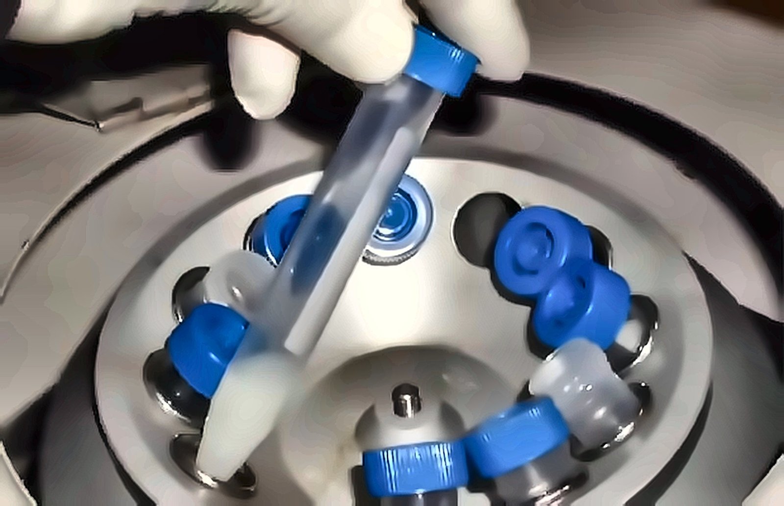 Insémination artificielle — préparation du sperme par centrifugation