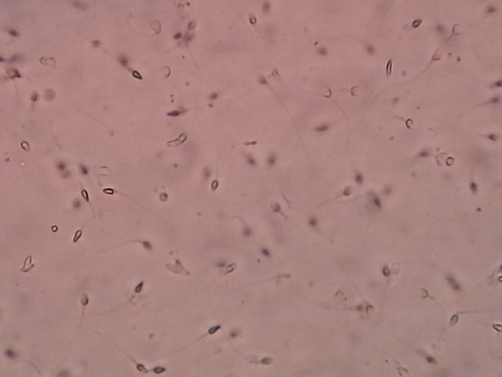 Spermatozoïdes au microscope — détection de la fragmentation de l'ADN